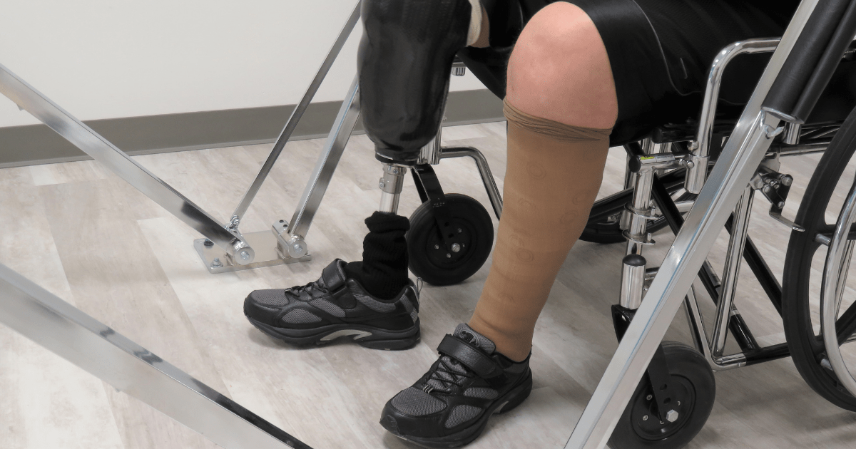 Loss of Limb Compensation and Claim